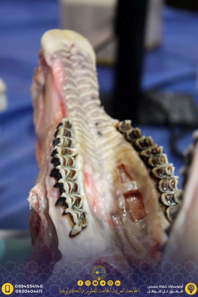 ورشة الطعوم العظمية